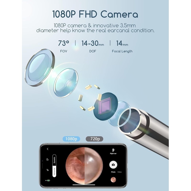 Qimic Ear Wax Removal, Ear Cleaner with Camera and Light,