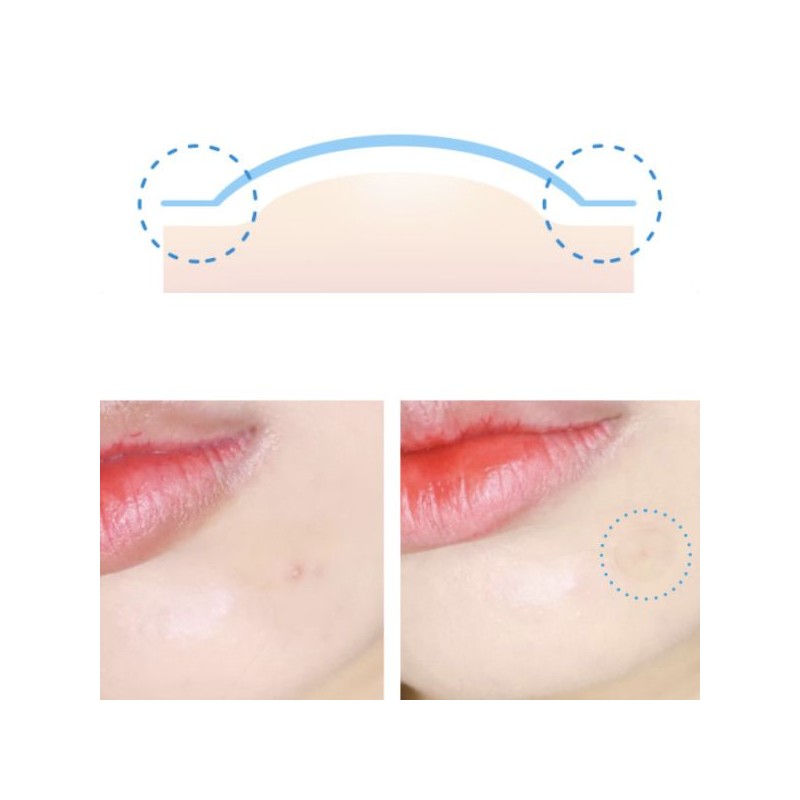 ARIUL True AC Spot Cover Patch After 110patches