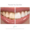 Glim Professional Teeth Whitening Strips| 42 Strips (21 Treatments), Hydrogen-Free,