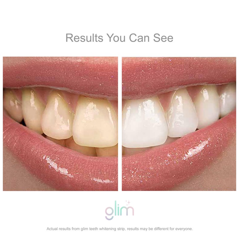 Glim Professional Teeth Whitening Strips| 42 Strips (21 Treatments), Hydrogen-Free,