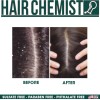 Champú Hair Chemist Cuero Cabelludo Seco Menta Anticaspa 1l