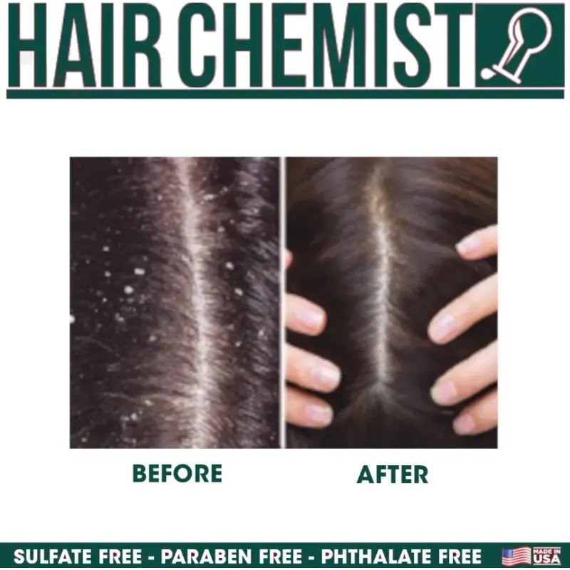 Champú Hair Chemist Cuero Cabelludo Seco Menta Anticaspa 1l