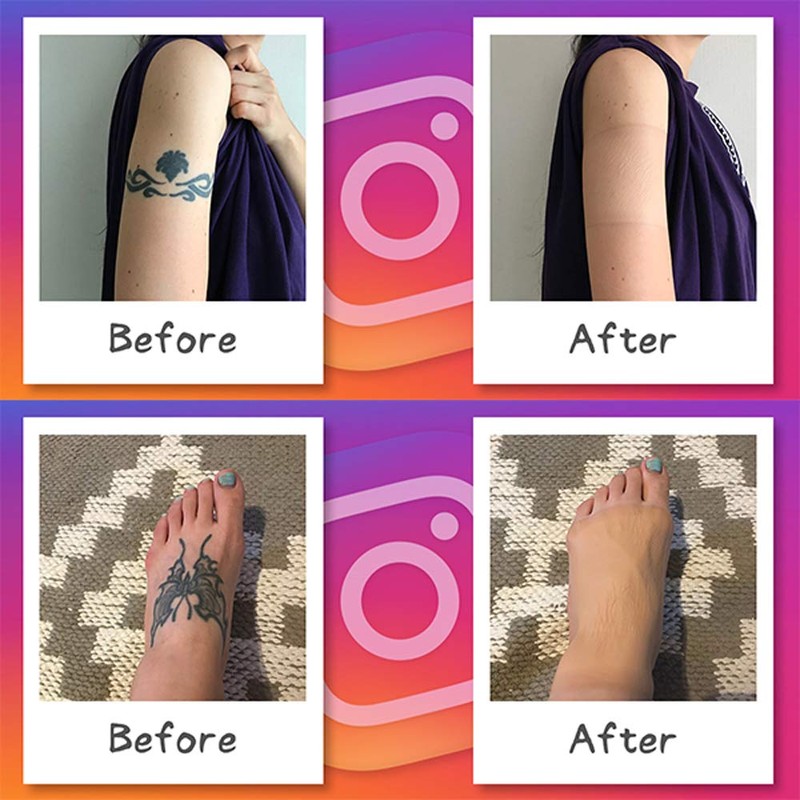 Foundation Tape (Temporary Tattoo Concealer Stickers to Hide Tattoos) Standard