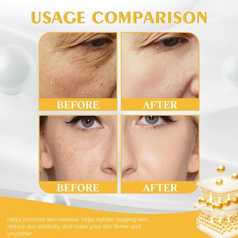 2PCS Bee Venom Retinol Cream, 2025 New Bee Venom Retinol