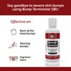 BREEJ Bump Terminator Severe Bumps Lotion (4oz)