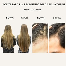 Forest & Shore Aceite para el crecimiento del cabello, 100% natural, con cafeína, biotina, ricino, argán y romero, suero eficaz para cabello dañado