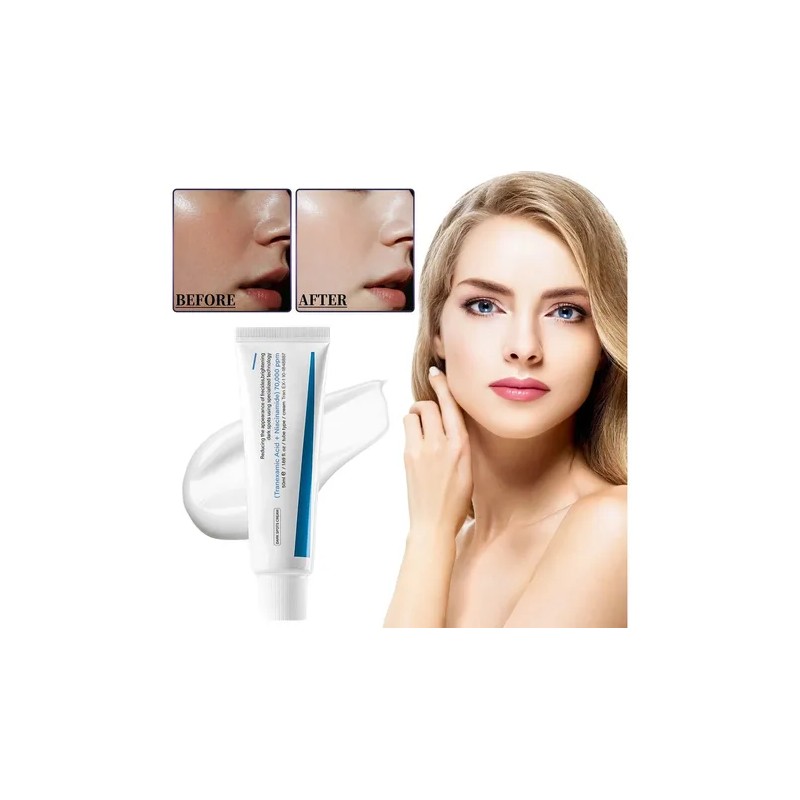 Crema Tx Para Manchas Oscuras E Hiperpigmentación Tx Tranexa
