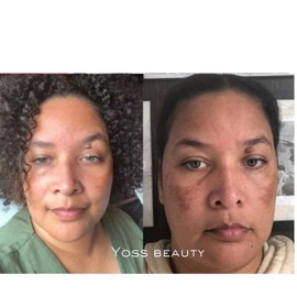 Dark Spot Correcting Serum, Collagen Brightening Facial Serum