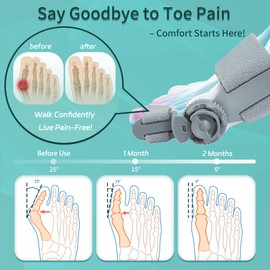 Bunion Corrector for Women Big Toe, Orthopedic Bunions Correction with Non-Slip Toe Separators for Women, Adjustable Toe Straightener Suitable for Left/Right Feet Hallux Valgus Relief (1, Gray)