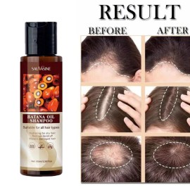 Champú Aceite Batana para el Crecimiento del Cabello Anti Pérdida de Cabello Humedad Natural Cabello Suave