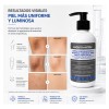 Exderm White Crema Despigmentante Intensiva Corporal 250