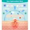 Hydrocolloid Roll 5CM*3M, Hydrocolloid Bandages Roll, Para el Cuidado de