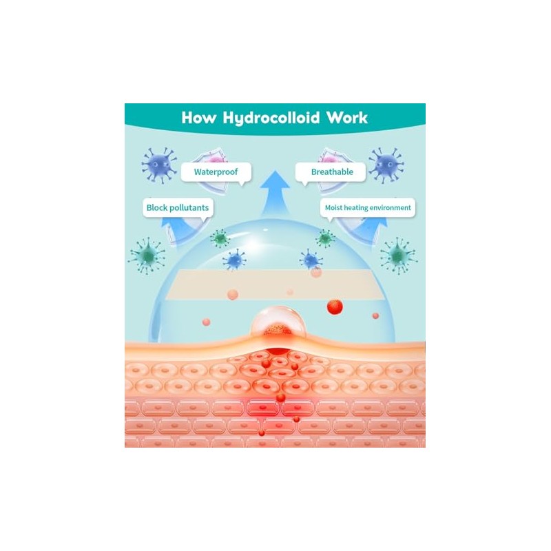 Hydrocolloid Roll 5CM*3M, Hydrocolloid Bandages Roll, Para el Cuidado de