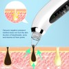 Electric Facial Pore Cleansing Remove Blackhead Acne Vacuum Suction Instrument