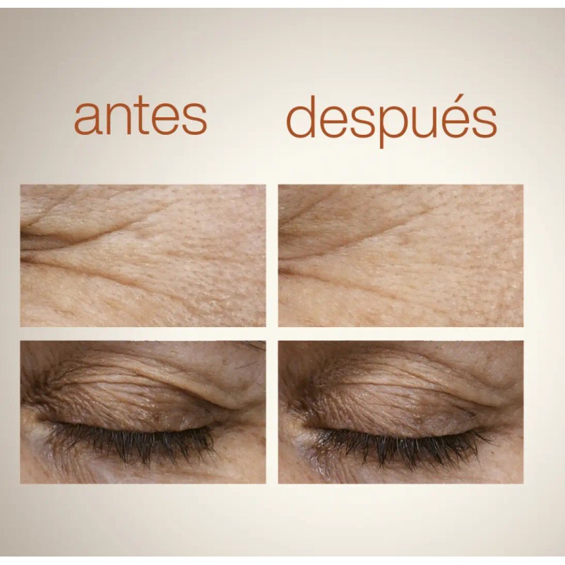 Super Serum Reductor De Arrugas Y Flacidez Repuesto 15ml
