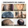 Espuma Con Biotina Crecimiento Barba Cuero Cabelludo Kit 2pz