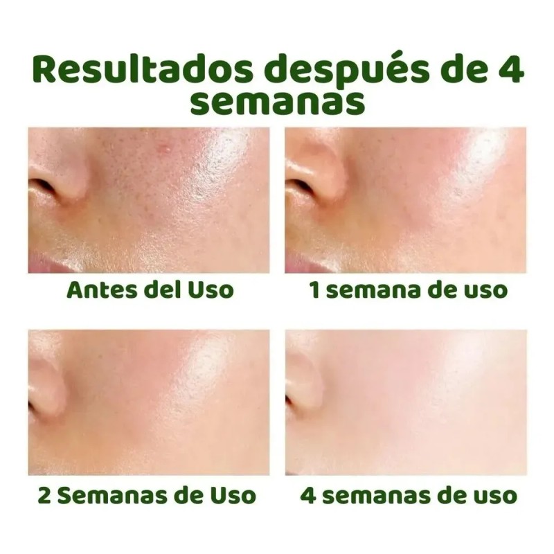 Gc Sérum Facial Reductor Poros Acido Salicílico Anti Acné