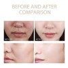 Melaxina Coreana Shot Peel Rice Dr. Exfoliating Essence