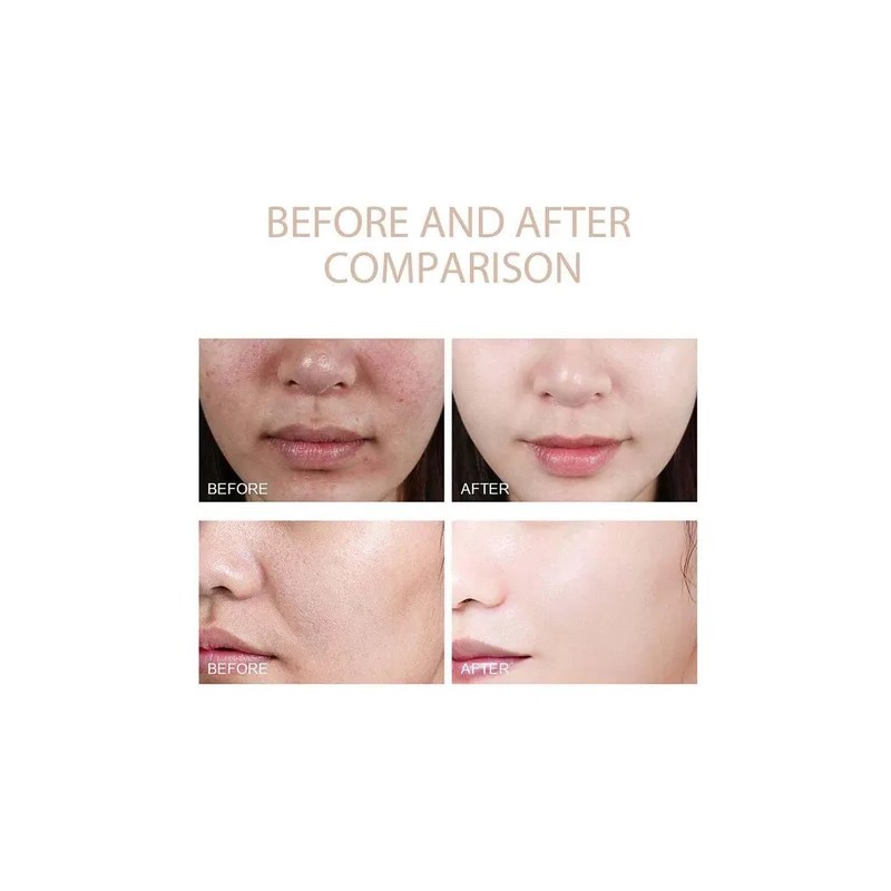 Melaxina Coreana Shot Peel Rice Dr. Exfoliating Essence