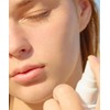 Rorobell [Teen·Adult Acne Relief Mist] Twinkle Mist 100ml