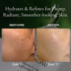 New Day Glow – Crema Iluminadora De Bakuchiol Con Vitamina C Y Niacinamida Alternativa Al Retinol Para Antienvejecimiento Y Luminosidad Hidrata, Reafirma Y Reduce Las Líneas De Expresión,