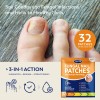 Tratamiento De Hongos En Las Uñas De Los Pies Vigorwell