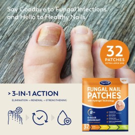 Tratamiento De Hongos En Las Uñas De Los Pies Vigorwell Over
