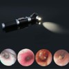 Mini Otoscope, Bysameyee Magnification Diagnostic Otoscope with LED Direct Illumination