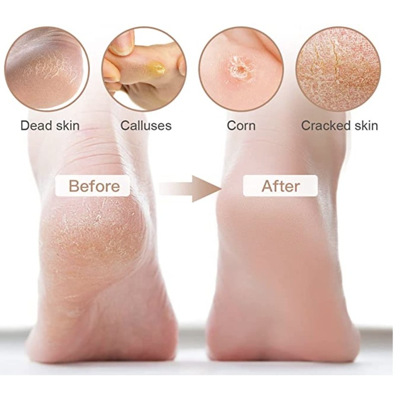 Basicare Professional Pedicure 9 Piece Kit