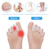COOLWAVE Toe Separator Toe Spacer for Men and Women, Toe