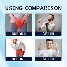 Pro-state Treatment Gel,Pro-state Natural Herbal Gel,Pro-state Care Cream for Men,Pro-state Health Products All Skin Types