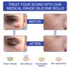 Self-adhesive Silicone Scar Patch 1.6x120 inches Transparent Invisible Scar Sheets