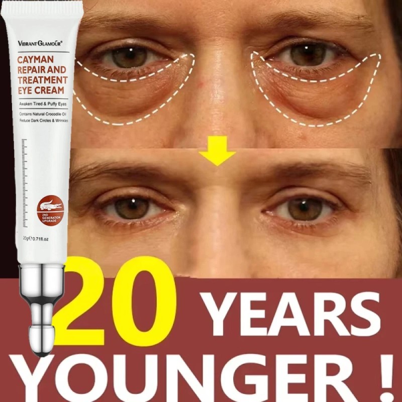 2PCS Instant Remove Dark Circles Wrinkles Face Lines Puffy Eyes