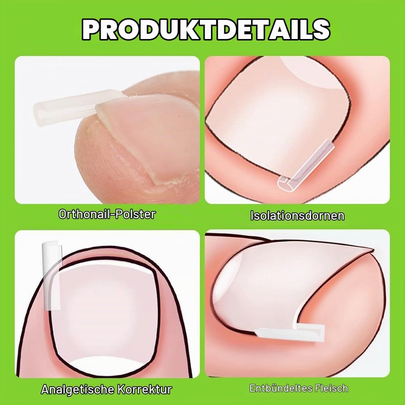 50 Pieces Nail Clips Set for Correction Ingrown Toenails, Toenail