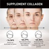 Eelhoe Eternity Vitamin C Serum Dark Spot Corrector, Esencia de