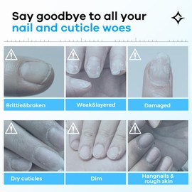 Glamonade Hard Nail Strengthening Cream: Nail strengthener and Cuticle Treatment To Repair Damaged Thin Nails and Dry Cracked Skin&Grow Nails, Plant-Based Scent, 1 oz,Essential Nail Care