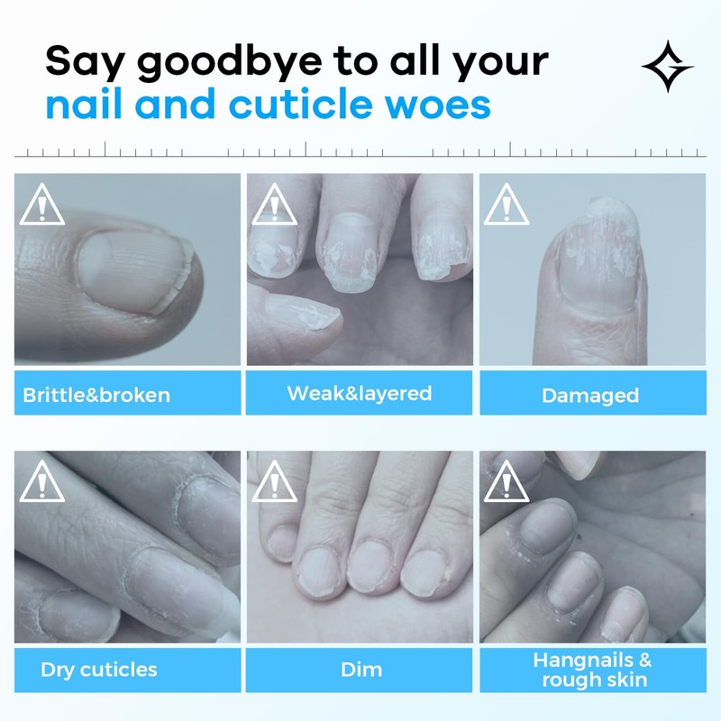 Glamonade Hard Nail Strengthening Cream: Nail strengthener and Cuticle Treatment