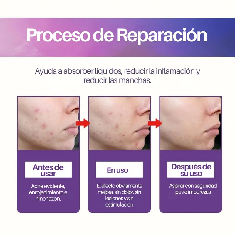Parches Cubre Acné Estrellas