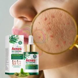 Sérum Universo en Linea Ácido Salicílico Té Verde Control Acné Facial 30mL