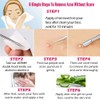 Blackhead Remover Comedone Squeezer Set, elloLife Blackhead Remover with Stainless