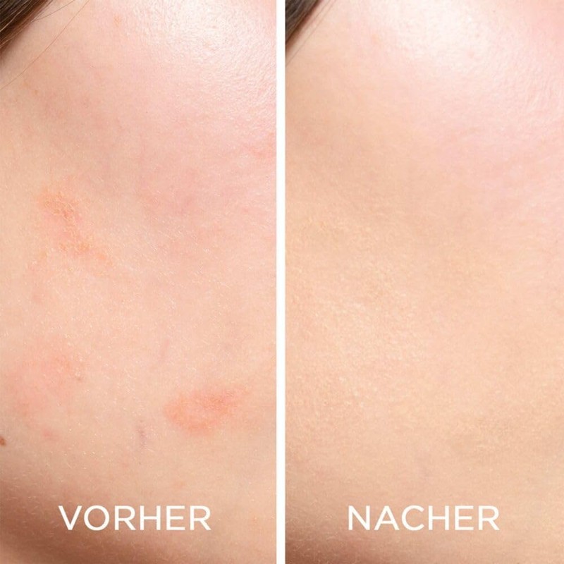 Artdeco Perfect Complexion Concealer, Liquid Concealer for Covering Dark Circles