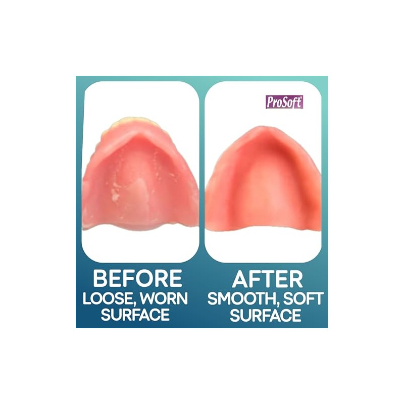 Prosoft revestimiento para dentaduras postizas 2 placas para dentaduras postizas.