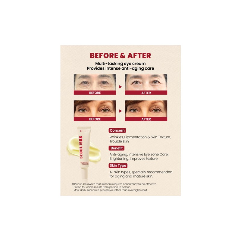 KSECRET [KSECRET]*TIMEDEAL* SEOUL 1988 Eye Cream : Retinal Liposome 4%