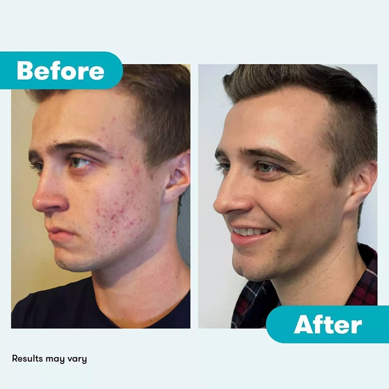 Proactiv Toner Revitalizador Paso 2 Tónico 60 Días 120ml