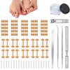 Professional Ingrown Toenail Set with Breathable Ingrown Toenail Strips, Curved