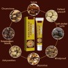 Xinnuo Crema Para La Artritis, Pomada Para Aliviar El Dolor