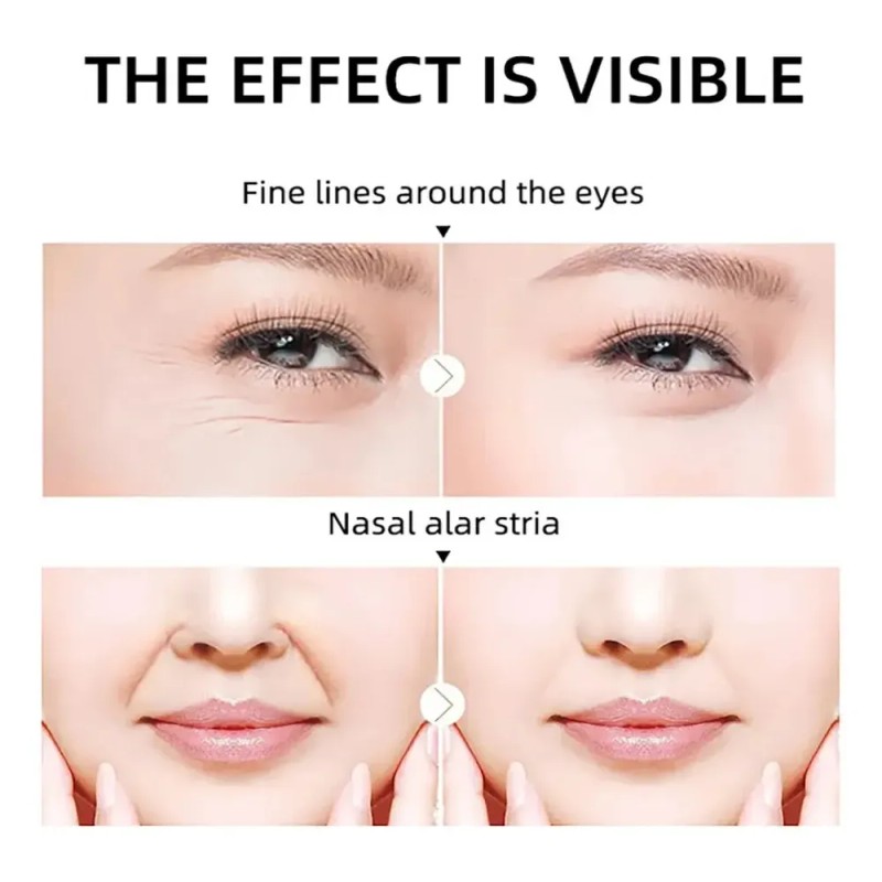 Esencia Facial 4 En 1 Que Elimina Manchas Y Humecta
