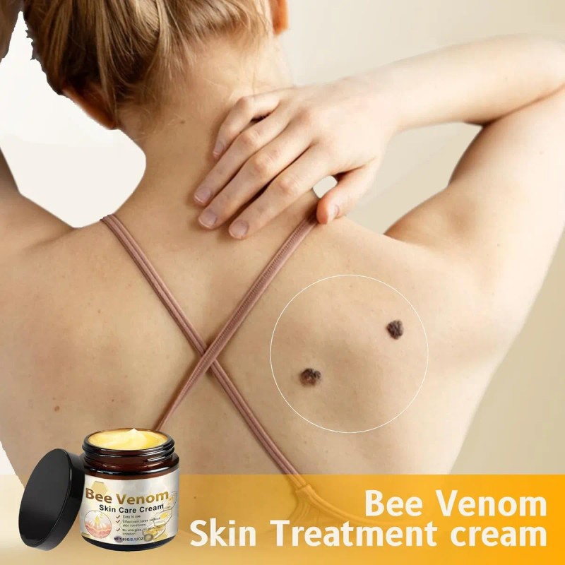 Fsx Crema Para El Cuidado De La Piel, Reduce Todo