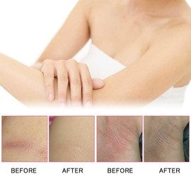 MINGRUO Anti-chafing stick, anti-chafing stick, anti-chafing balm, reduces friction and skin irritation for skin areas such as thighs (B, 40 g)