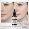 Serum V-tranex Despigmentante Acido Tranexamico Mancha 30ml Todo Tipo De